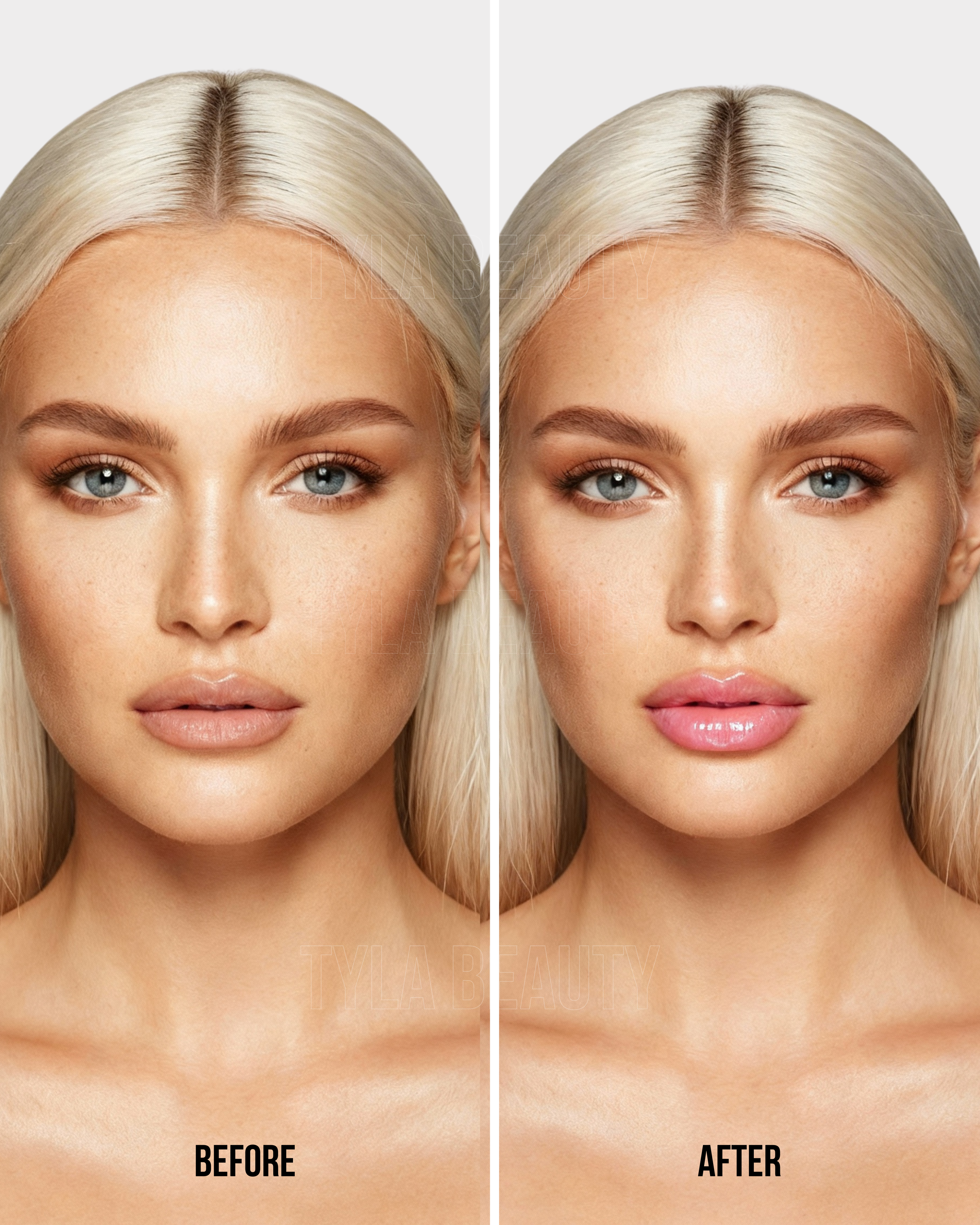 Extreme Instant Lip Filler Plumper (2ml)